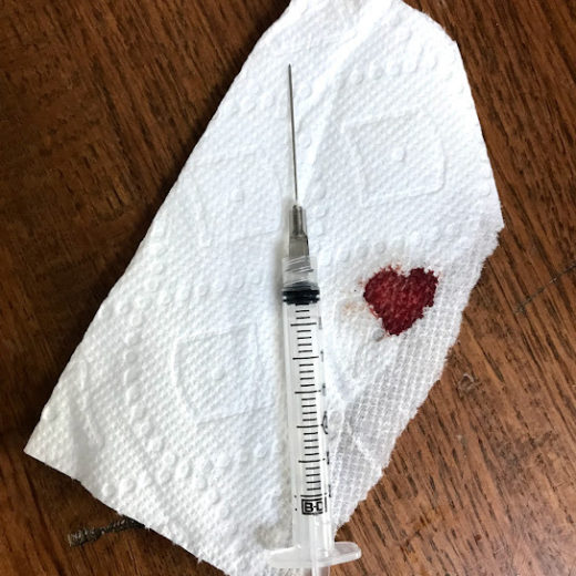 An injection needle for IVF