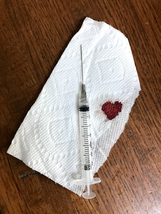 An injection needle for IVF